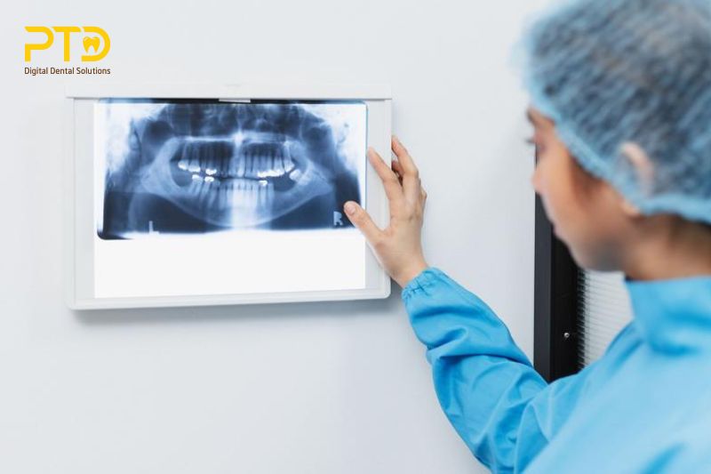 Chụp X-quang răng là gì?