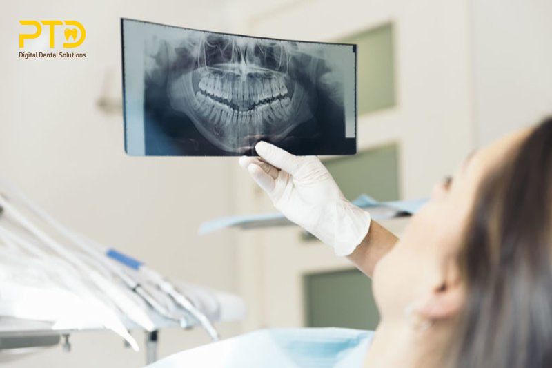 Chụp X-quang răng có an toàn không?