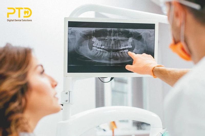 X-quang trong nha khoa là gì?