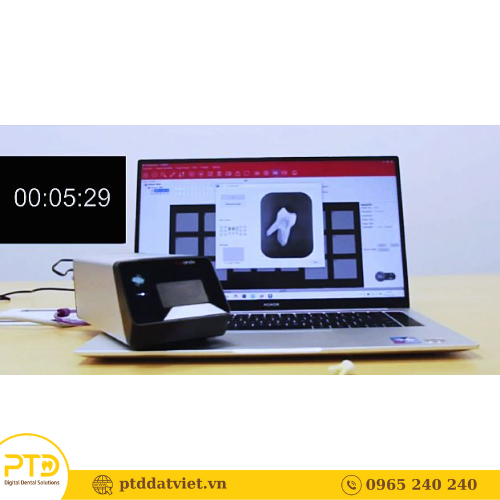 Tốc độ quét phim chỉ khoảng 5s