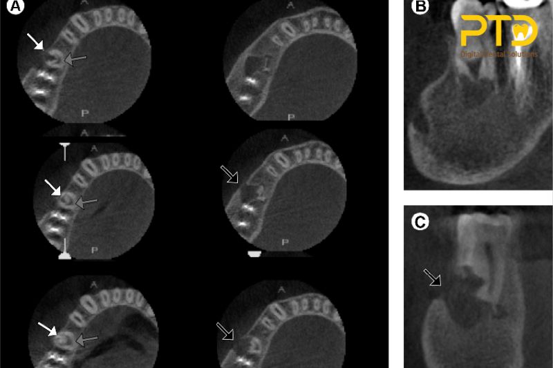 Nguyên Lý hoạt động của máy CBCT