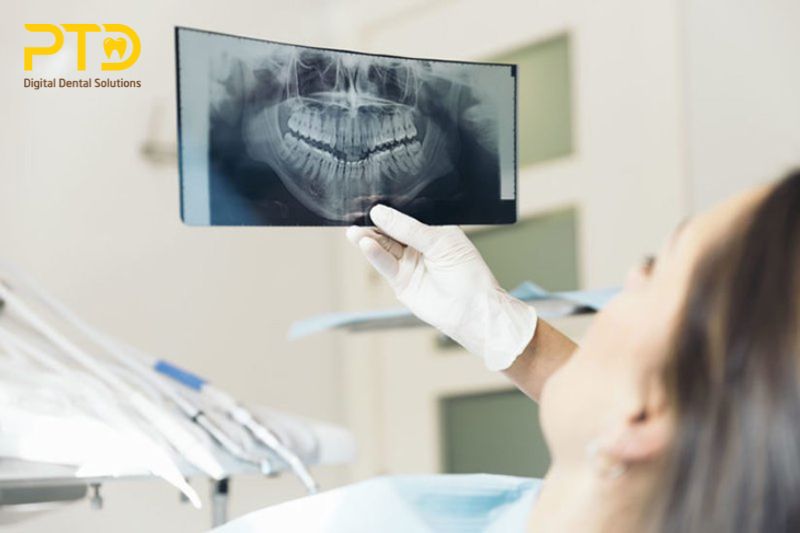 Giá máy chụp CT răng trên thị trường hiện nay