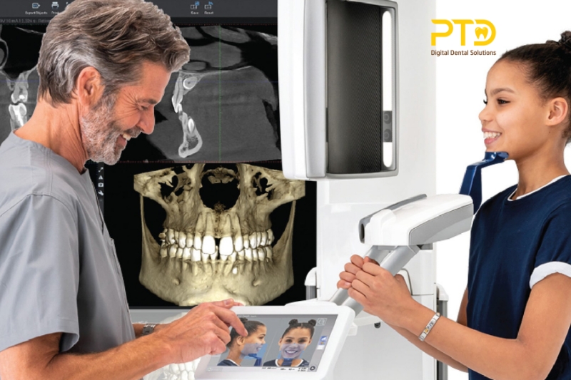 Ưu điểm và nhược điểm của CBCT