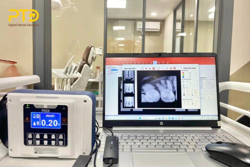 Hướng dẫn chọn mua thiết bị nha khoa năm 2024