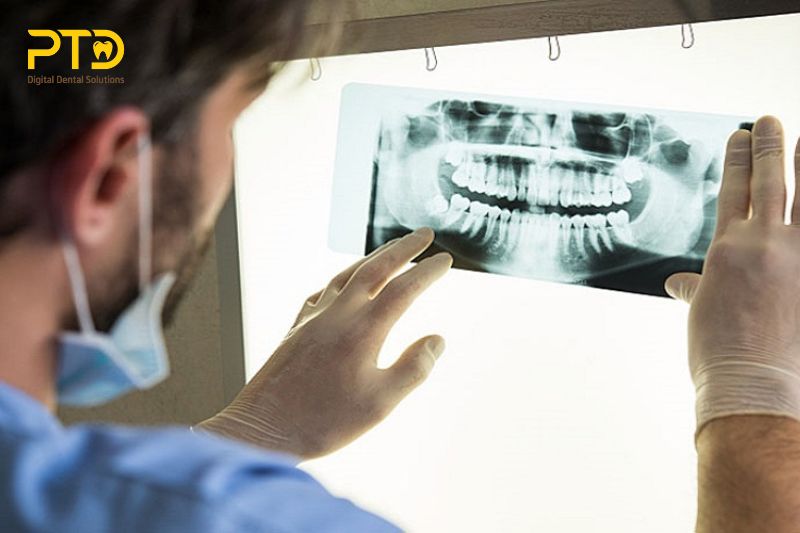 Máy chụp X-quang nha khoa là gì?