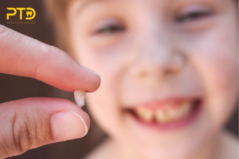 Các yếu tố ảnh hưởng đến việc mất khoảng