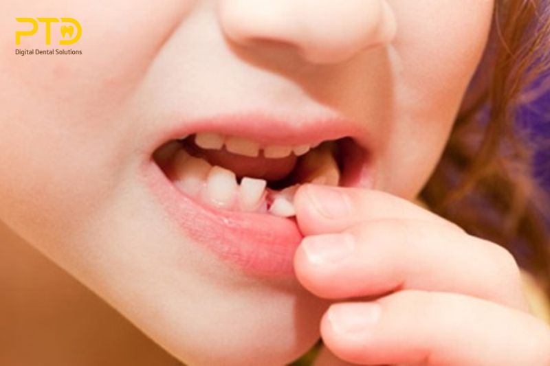 Các yếu tố ảnh hưởng đến việc mất khoảng