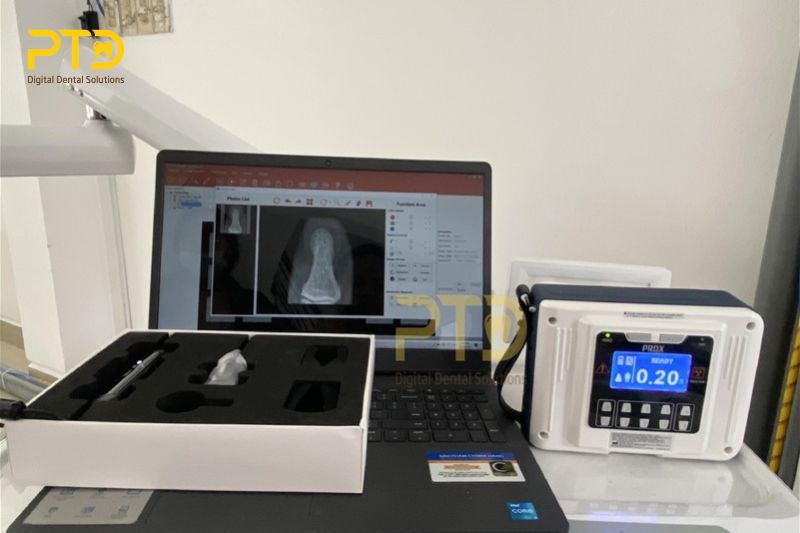 Các phương pháp chụp X-quang trong nha khoa hiện nay